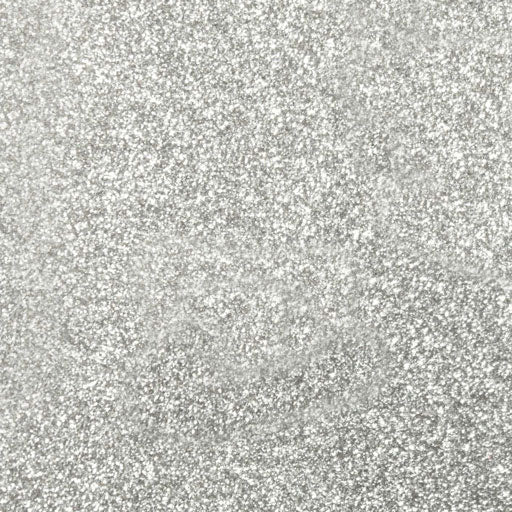 Siser Glitter Silver HTV 12"